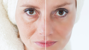 Anti-aging for Women