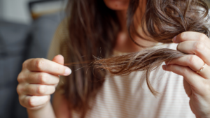 What Causes Sudden Hair Loss in Females