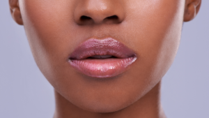 Lip care tips for dark lips
